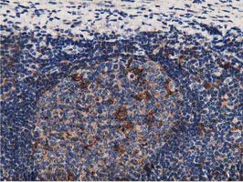 m06548 anti growth arrest specific protein 7 gas7 mouse monoclonal antibody clone id oti8h10 ihc testing 5