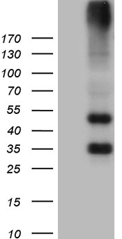HEK293T cells were transfected with the pCMV6-ENTRY control (Left lane) or pCMV6-ENTRY GRM4 (Right lane) cDNA for 48 hrs and lysed. Equivalent amounts of cell lysates (5 ug per lane) were separated by SDS-PAGE and immunoblotted with anti-GRM4 (1:2000).