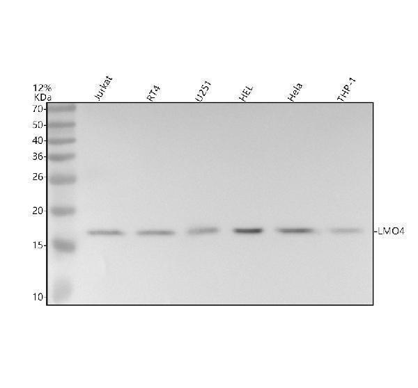 Western blot analysis of LMO4 using anti-LMO4 antibody (M06555)