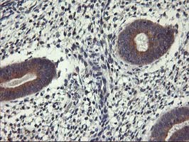 Immunohistochemical staining of paraffin-embedded Human endometrium tissue within the normal limits using anti-ALG2 mouse monoclonal antibody
