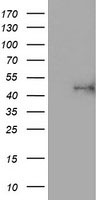 HEK293T cells were transfected with the pCMV6-ENTRY control (Left lane) or pCMV6-ENTRY ALG2 (Right lane) cDNA for 48 hrs and lysed