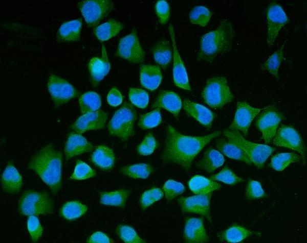 m06559 sema3b primary antibodies if testing 2
