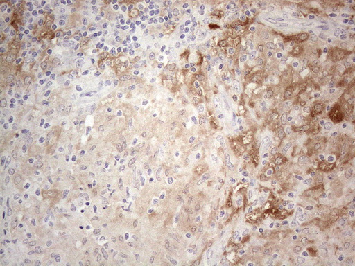 m06587 anti ppa2 mouse monoclonal antibody clone id oti7c1 ihc testing 3