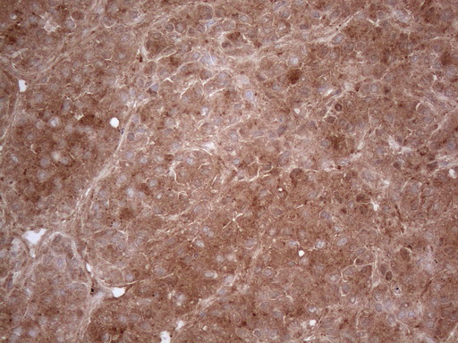 m06587 anti ppa2 mouse monoclonal antibody clone id oti7c1 ihc testing 4
