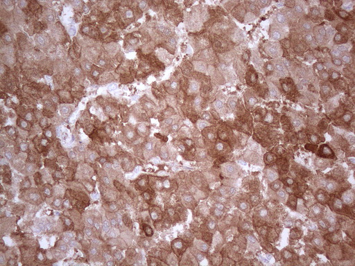 m06587 anti ppa2 mouse monoclonal antibody clone id oti7c1 ihc testing 5