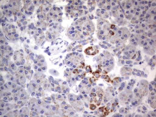 m06593 anti chchd3 mouse monoclonal antibody clone id oti7g4 ihc testing 4