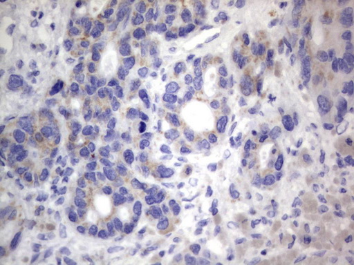 m06593 anti chchd3 mouse monoclonal antibody clone id oti7g4 ihc testing 5