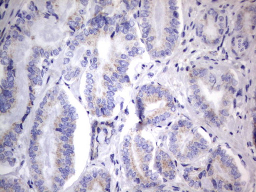 m06593 anti chchd3 mouse monoclonal antibody clone id oti7g4 ihc testing 6