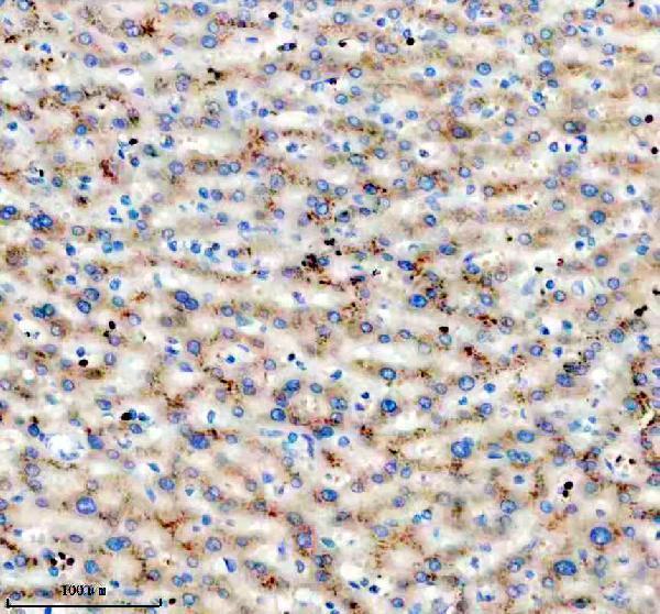 IHC analysis of VPS15/PIK3R4 using anti-VPS15/PIK3R4 antibody (M06618-1)