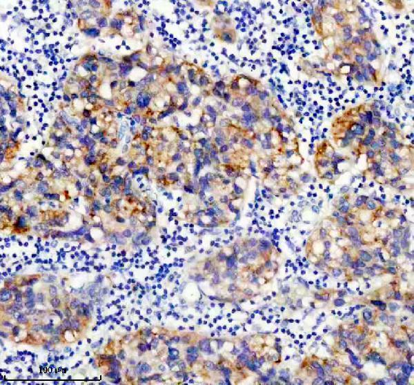 IHC analysis of VPS15/PIK3R4 using anti-VPS15/PIK3R4 antibody (M06618-1)
