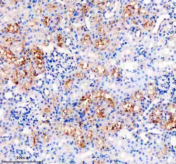 m06618 1 pik3r4 primary antibodies ihc testing 3
