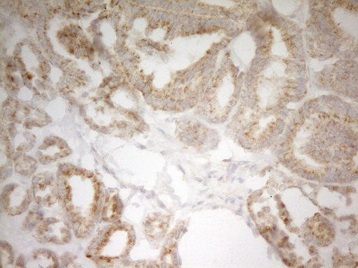 m06618 anti pi 3 kinase regulatory subunit 4 pik3r4 mouse monoclonal antibody clone id oti5d1 ihc testing 1