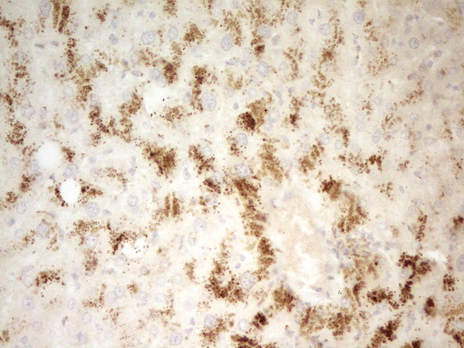 m06618 anti pi 3 kinase regulatory subunit 4 pik3r4 mouse monoclonal antibody clone id oti5d1 ihc testing 2