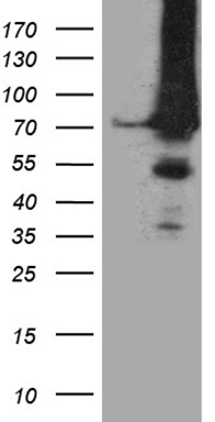 HEK293T cells were transfected with the pCMV6-ENTRY control (Left lane) or pCMV6-ENTRY APPL2 (Right lane) cDNA for 48 hrs and lysed. Equivalent amounts of cell lysates (5 ug per lane) were separated by SDS-PAGE and immunoblotted with anti-APPL2.
