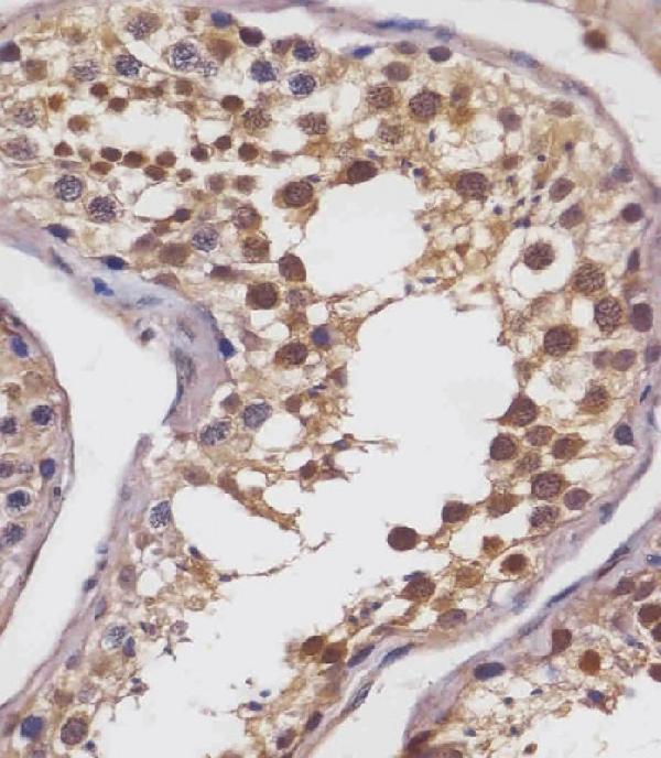 M06641 staining SLC2A8 in human testis tissue sections by Immunohistochemistry (IHC-P -paraformaldehyde-fixed, paraffin-embedded sections). Tissue was fixed with formaldehyde and blocked with 3% BSA for 0. 5 hour at room temperature; antigen retrieval was by heat mediation with a citrate buffer (pH6). Samples were incubated with primary antibody (1/25) for 1 hours at 37°C. A undiluted biotinylated goat polyvalent antibody was used as the secondary antibody.