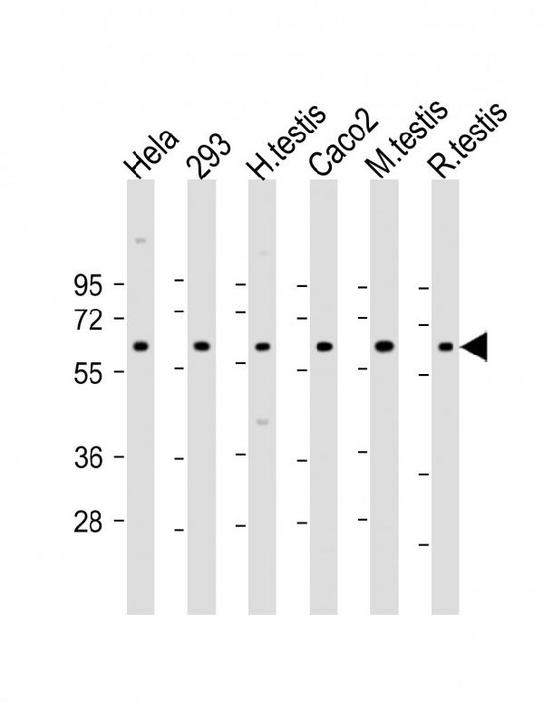 All lanes : Anti-SLC2A8 Antibody (Center) at 1:2000 dilution Lane 1: Hela whole cell lysate Lane 2: 293 whole cell lysate Lane 3: human testis lysate Lane 4: Caco2 whole cell lysate Lane 5: mouse testis lysate Lane 6: rat testis lysate Lysates/proteins at 20 microg per lane. Secondary Goat Anti-Rabbit IgG, (H+L), Peroxidase conjugated at 1/10000 dilution. Predicted band size : 51 kDa Blocking/Dilution buffer: 5% NFDM/TBST.