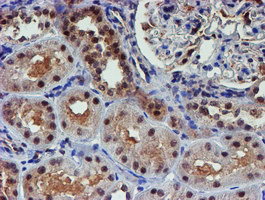 m06642 anti psmd2 mouse monoclonal antibody clone id oti1g6 ihc testing 10