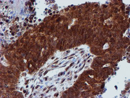 m06642 anti psmd2 mouse monoclonal antibody clone id oti1g6 ihc testing 3