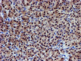 m06642 anti psmd2 mouse monoclonal antibody clone id oti1g6 ihc testing 4