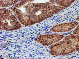 m06642 anti psmd2 mouse monoclonal antibody clone id oti1g6 ihc testing 5