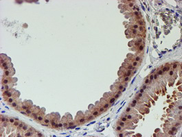 m06642 anti psmd2 mouse monoclonal antibody clone id oti1g6 ihc testing 6
