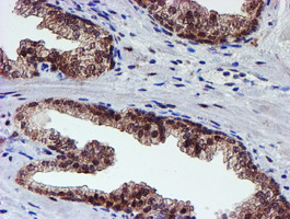 m06642 anti psmd2 mouse monoclonal antibody clone id oti1g6 ihc testing 7
