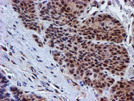 m06642 anti psmd2 mouse monoclonal antibody clone id oti1g6 ihc testing 8