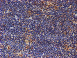 m06642 anti psmd2 mouse monoclonal antibody clone id oti1g6 ihc testing 9