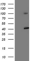 m06642 anti psmd2 mouse monoclonal antibody clone id oti1g6 wb testing 1