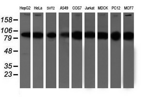 m06642 anti psmd2 mouse monoclonal antibody clone id oti1g6 wb testing 2
