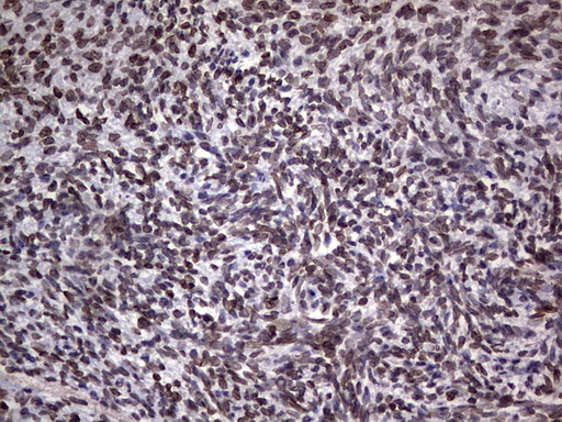 Immunohistochemical staining of paraffin-embedded Human Ovary tissue within the normal limits using anti-TLK2 mouse monoclonal antibody
