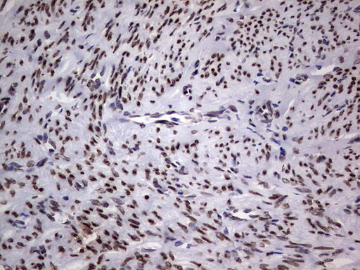 m06645 1 anti tlk2 mouse monoclonal antibody clone id oti2g1 ihc testing 4