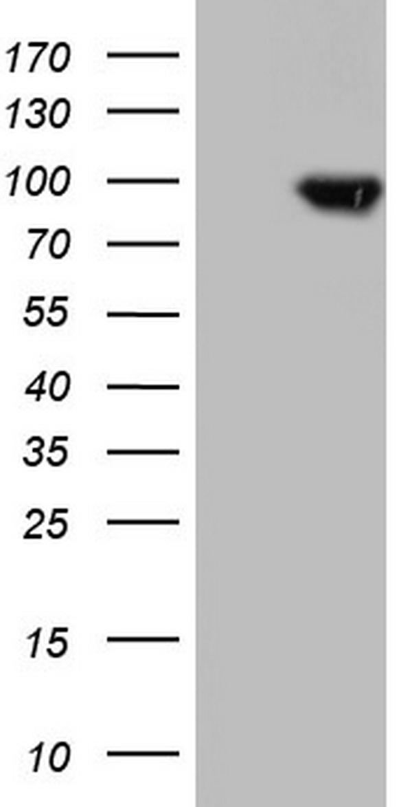 HEK293T cells were transfected with the pCMV6-ENTRY control (Left lane) or pCMV6-ENTRY TLK2 (Right lane) cDNA for 48 hrs and lysed