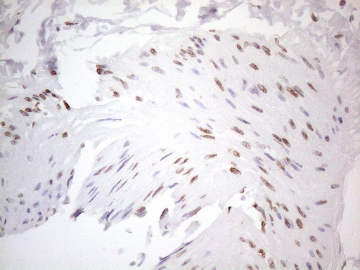 m06645 anti tlk2 mouse monoclonal antibody clone id oti2d10 ihc testing 10