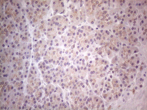 Immunohistochemical staining of paraffin-embedded Human pancreas tissue within the normal limits using anti-TLK2 mouse monoclonal antibody