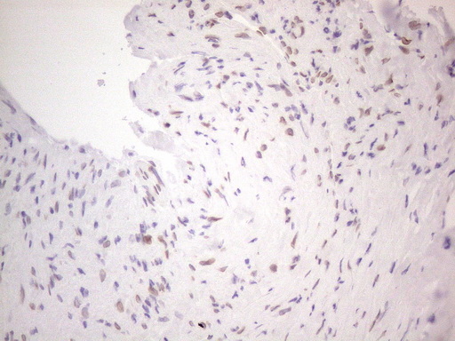 m06645 anti tlk2 mouse monoclonal antibody clone id oti2d10 ihc testing 4
