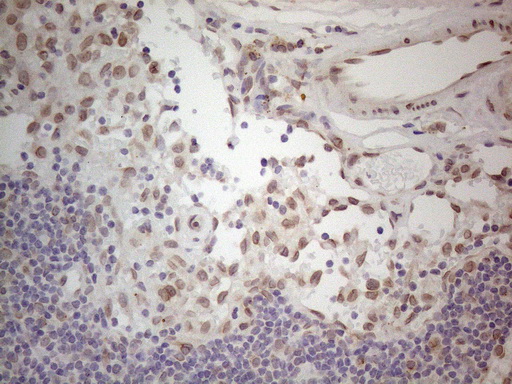 m06645 anti tlk2 mouse monoclonal antibody clone id oti2d10 ihc testing 5