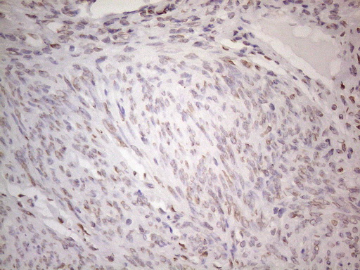 m06645 anti tlk2 mouse monoclonal antibody clone id oti2d10 ihc testing 6