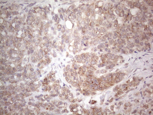 m06645 anti tlk2 mouse monoclonal antibody clone id oti2d10 ihc testing 7