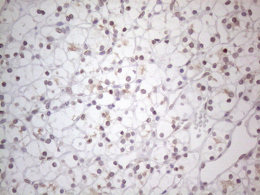 m06645 anti tlk2 mouse monoclonal antibody clone id oti2d10 ihc testing 8