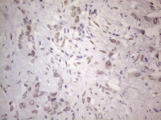 m06645 anti tlk2 mouse monoclonal antibody clone id oti2d10 ihc testing 9
