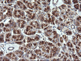 m06649 anti vti1a mouse monoclonal antibody clone id oti1f4 ihc testing 4