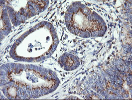 m06649 anti vti1a mouse monoclonal antibody clone id oti1f4 ihc testing 5
