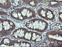 m06649 anti vti1a mouse monoclonal antibody clone id oti1f4 ihc testing 6