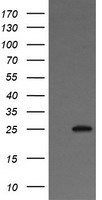 HEK293T cells were transfected with the pCMV6-ENTRY control (Left lane) or pCMV6-ENTRY VTI1A (Right lane) cDNA for 48 hrs and lysed