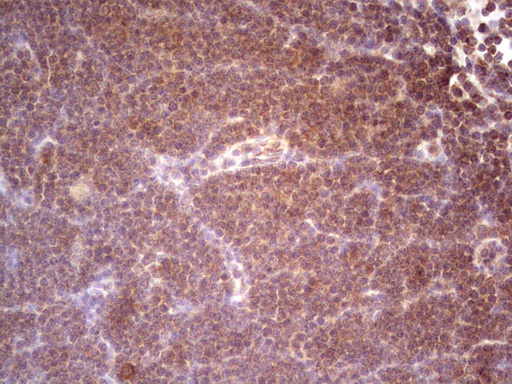 m06653 anti desmuslin synm mouse monoclonal antibody clone id oti7h6 ihc testing 4