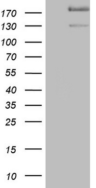 HEK293T cells were transfected with the pCMV6-ENTRY control (Left lane) or pCMV6-ENTRY SYNM (Right lane) cDNA for 48 hrs and lysed