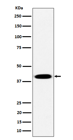 Western blot analysis of Pleckstrin expression in Raji cell lysate