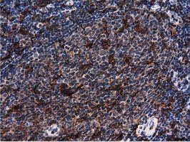 Immunohistochemical staining of paraffin-embedded Human lymph node tissue within the normal limits using anti-PLEK mouse monoclonal antibody