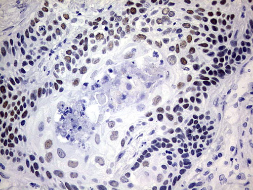m06669 anti nab1 mouse monoclonal antibody clone id oti1d2 ihc testing 2